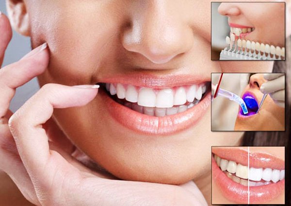 Cosmetic Dentistry