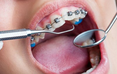 Orthodontics