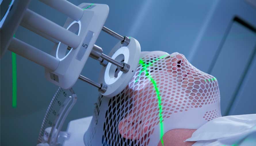 Radiation Therapy